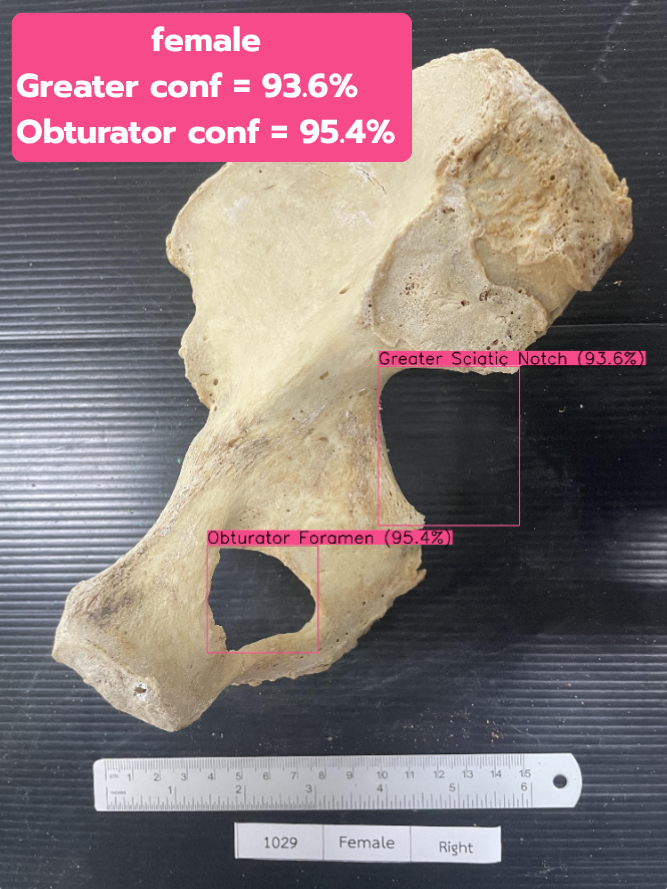 Greater & Obturator test 1