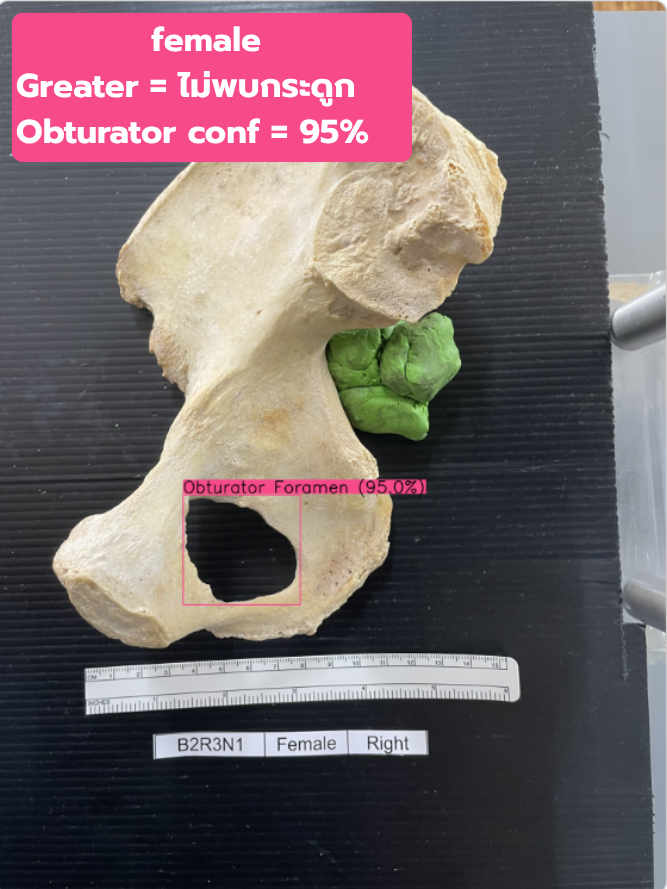 Bad Greater & Obturator test 2