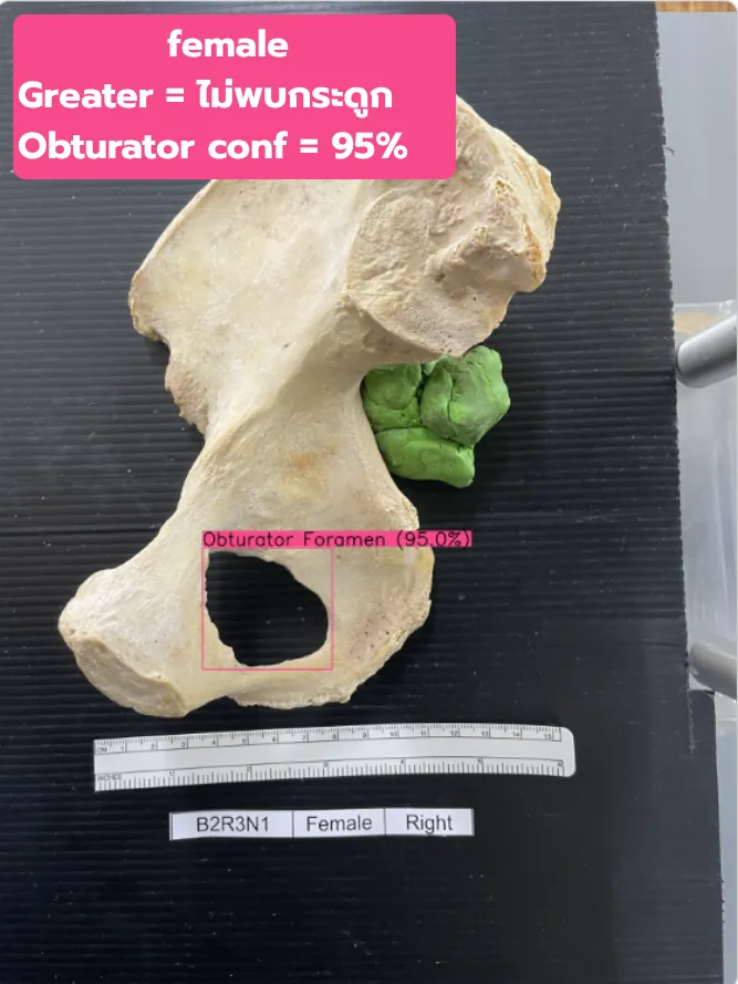 Bad Greater & Obturator test 2