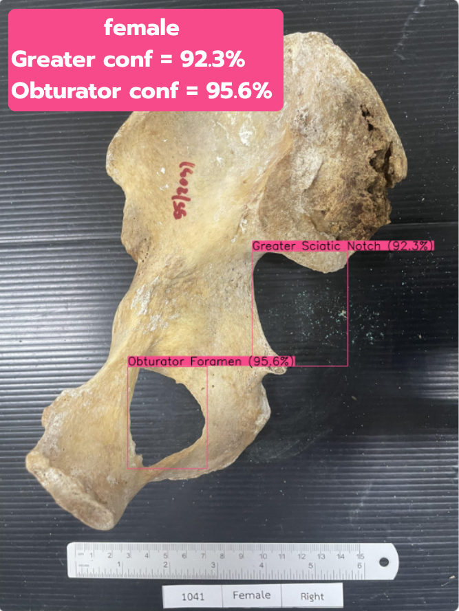 Greater & Obturator test 2