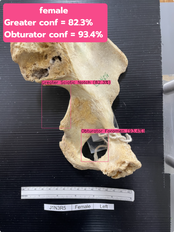 Bad Greater & Obturator test 3