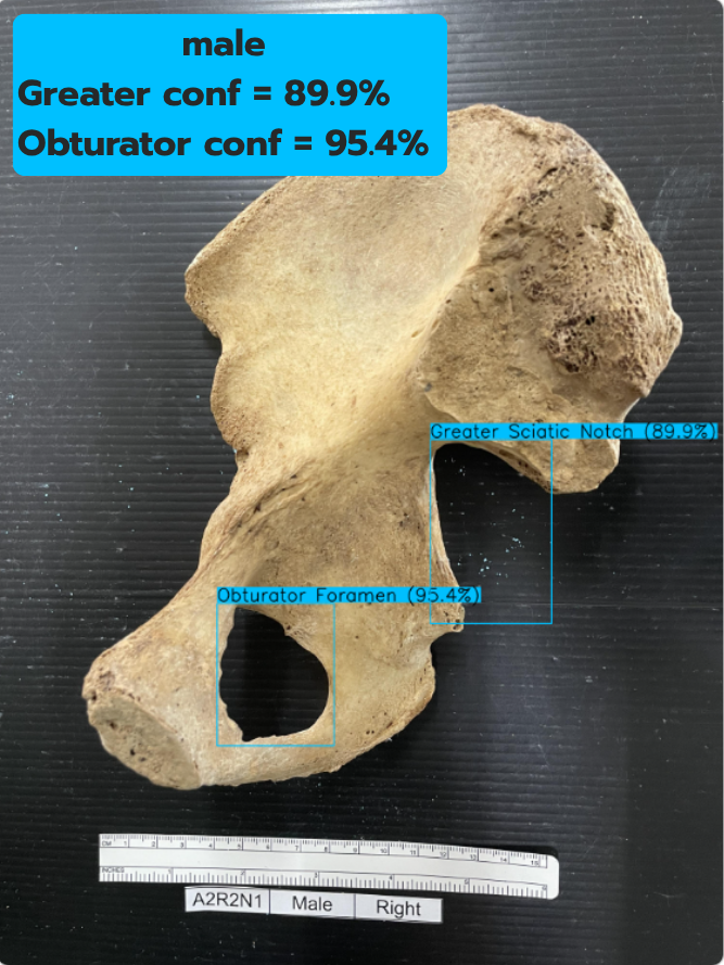 Greater & Obturator test 3