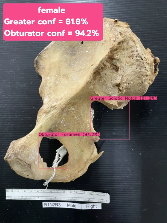 Bad Greater & Obturator test 4