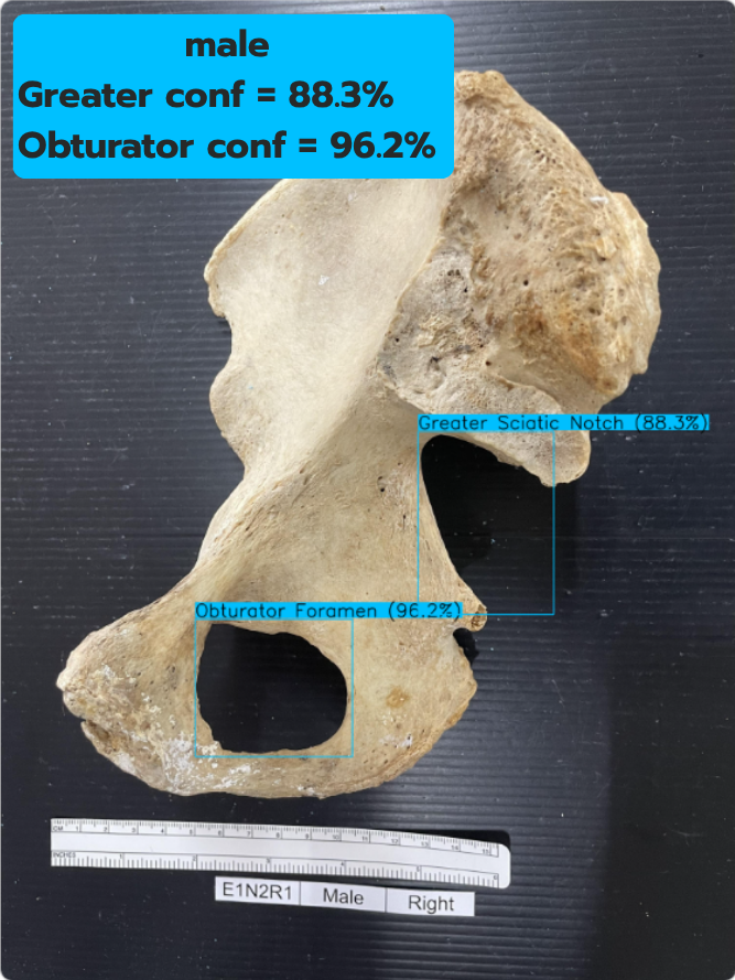 Greater & Obturator test 4